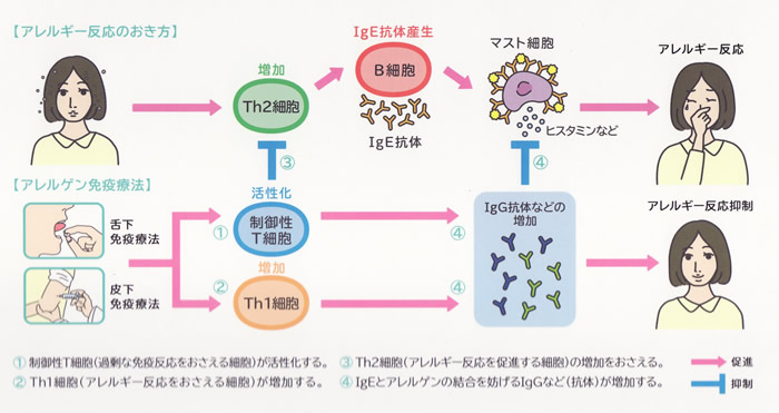 アレルギーの起き方と舌下免疫療法のメカニズム